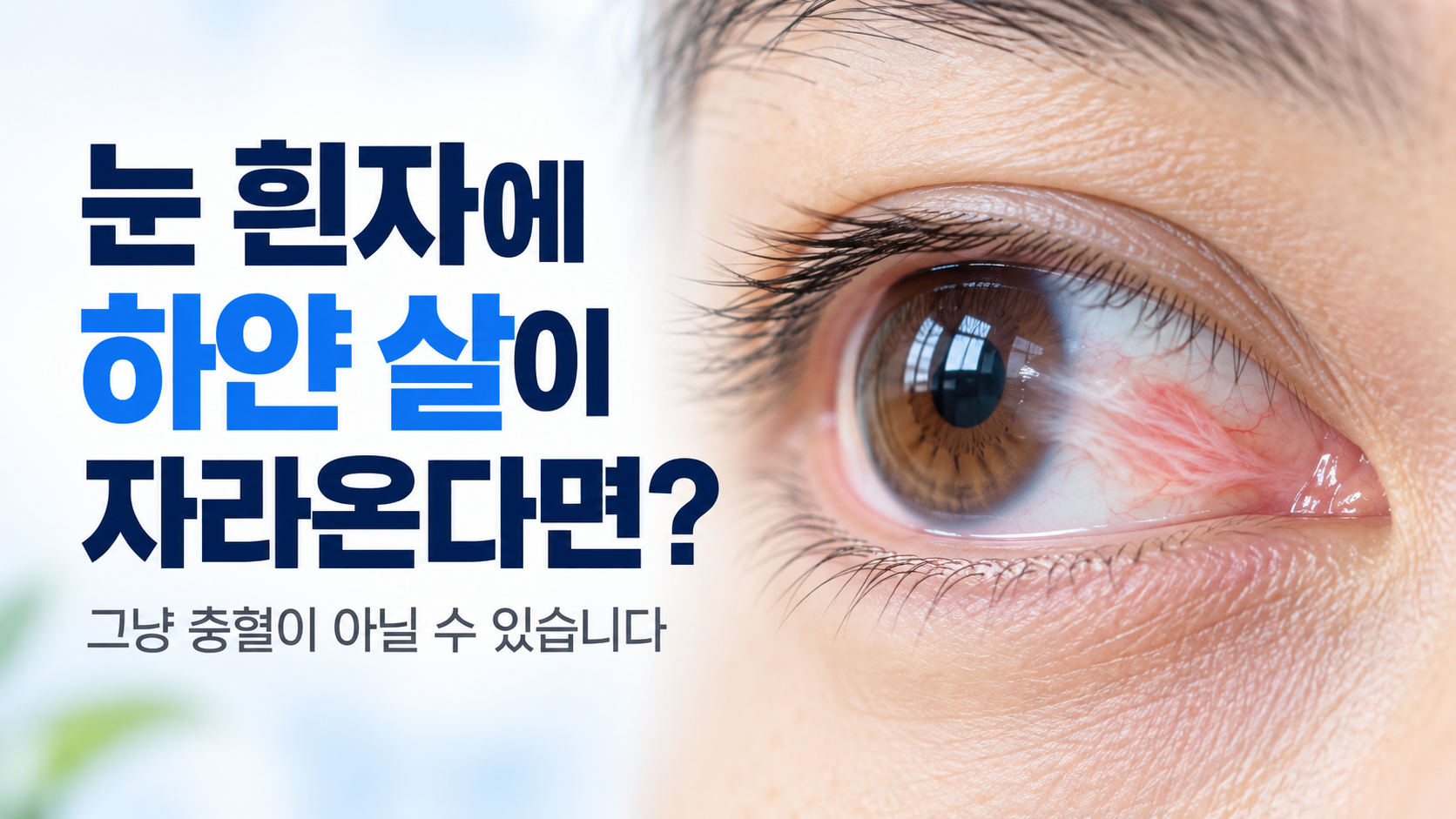 눈 흰자에 하얀 살이 자라오는 것 같다면? 그냥 충혈이 아닐 수 있습니다